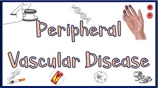 Peripheral Vascular DiseasePVD Causes Signs amp Symptoms Diagnosis ampTreatment [upl. by Leagiba543]