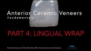 Anterior Ceramic Veneers Part 4 Lingual Wrap [upl. by Liscomb]