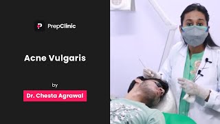 Acne Vulgaris  Dr Chesta Agrawal  Dermatology PrepClinic [upl. by Wetzel]