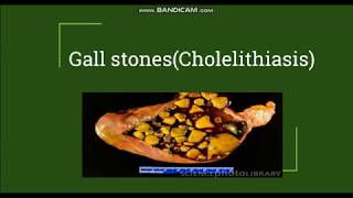 Cholelithiasis  Gallstones Pathogenesis amp Morphology [upl. by Tilden]