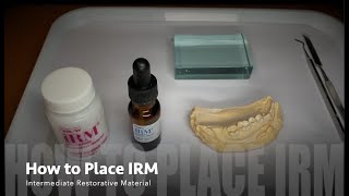 How to MixPlace IRM Intermediate Restorative Material [upl. by Anivek64]