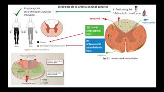 Lesiones de la Medula Espinal [upl. by Hembree359]