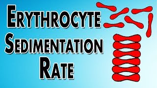 Erythrocyte Sedimentation Rate [upl. by Koehler86]