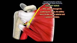 NERVE INJURY IN THE UPPER EXTREMITY Everything You Need To Know  Dr Nabil Ebraheim [upl. by Rilda482]