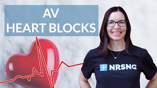 How to interpret AV Heart Blocks on an EKG strip [upl. by Lach]