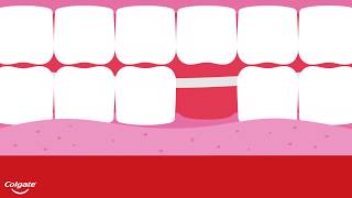 The Four Types of Dental Bridges [upl. by Calla540]