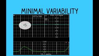 Renal Artery Doppler Protocol  Sonoquickies [upl. by Merow]