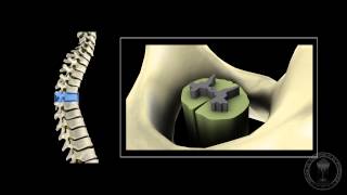 Neuroanatomy  The spinal cord [upl. by Ardnaed17]