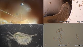 The Amazing Microscopic World [upl. by Radack865]