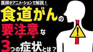 絶対に見逃してはならない食道がんの症状3選 [upl. by Levona]