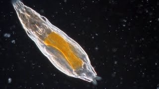 Bdelloid Rotifers so common yet so weird [upl. by Haslam368]