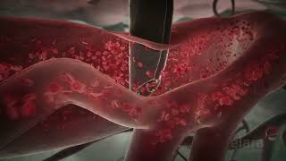 Malaria 3D Animation Shows How the Infection Spreads in the Body [upl. by Rolecnahc]