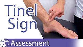 Tinels Sign Ankle⎟Peripheral Nerve Injury [upl. by Tierney]