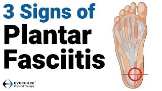 The 5 Things Anyone With Plantar Fasciitis Should Do Every Morning [upl. by Zabrine122]