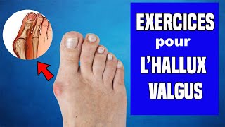 HALLUX VALGUS  TRAITEMENT ET EXERCICES KINÉ [upl. by Edwards]