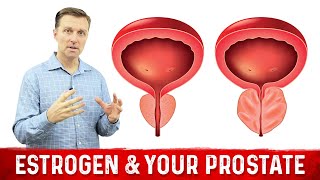 How To Fix Enlarged Prostate Explained By Dr Berg [upl. by Louanne]