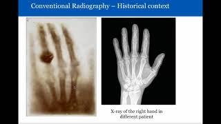 Introduction to Radiology Conventional Radiography [upl. by Nita811]