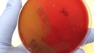 Microbiology  Hemolysis [upl. by Aliuqet]