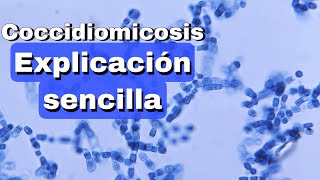 Coccidiomicosis fácil explicación [upl. by Pierpont]