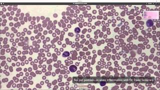 What blood looks like down the microscope [upl. by Hukill885]