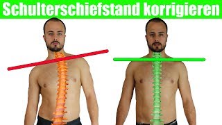 Schulterschiefstand beheben  Krumme Wirbelsäule  Brustkorb aufrichten [upl. by Neibaf99]