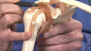 Shoulder Impingement  Dr Richard Hawkins [upl. by Eey]