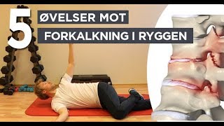 5 Øvelser mot Forkalkning i Ryggen [upl. by Madai]