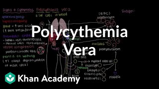 What is polycythemia vera  Hematologic System Diseases  NCLEXRN  Khan Academy [upl. by Gagnon480]