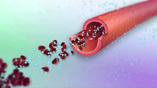 Colon Cancer Animation [upl. by Harwell]