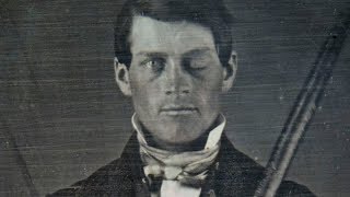 Why Scientists Are Still Fascinated By Phineas Gage [upl. by Nho]