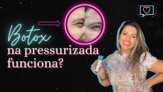 DESCUBRA COMO O BOTOX NA PRESSURIZADA FUNCIONA  Hyaluron Pen Intradermoterapia [upl. by Lidah]