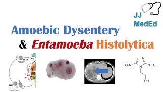 Amebiasis Amoebic Dysentery  Entamoeba histolytica Pathogenesis Signs amp Symptoms Treatment [upl. by Nashom928]