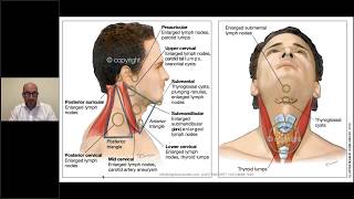 Neck lumps in general practice [upl. by Akeryt248]