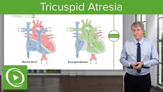 Tricuspid Atresia – Pediatric Cardiology  Lecturio [upl. by Amoreta]