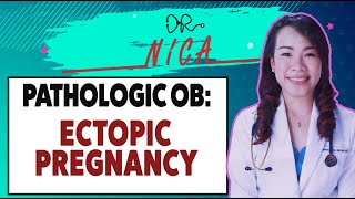 Lectures  Pathologic OB  Ectopic Pregnancy [upl. by Oneal]