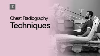 Chest Radiography Techniques [upl. by Korfonta]