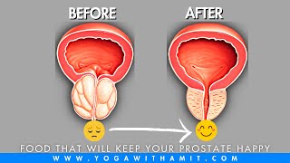 KEEP YOUR PROSTATE HAPPY  Here are some foods to eat and which to avoid [upl. by Enitnatsnoc]