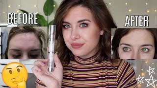 No7 Line Correcting Booster Serum Review Before  Afters [upl. by Emmie533]