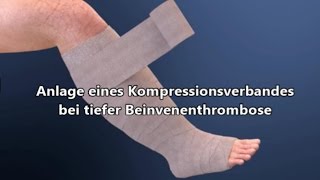 Kompressionsverband bei Thrombose [upl. by Ibbetson]