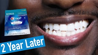 Crest 3D Whitestrips 2 Years Later How to Whiten Teeth EASY [upl. by Mccandless]