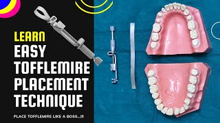 How to place Tofflemire matrix band  easy steps [upl. by Thorpe]