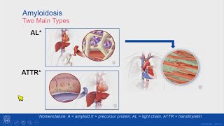 Mastering Coronary Angiography Image Intensifier amp Carm Fundamentals [upl. by Aytak984]