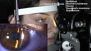 Ophthalmic Skills Series Part 15 [upl. by Nawtna]